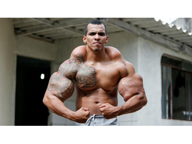 Man injects oil and alcohol in muscles to look like the Hulk, almost loses his arms Man injects oil and alcohol in muscles to look like the Hulk, almost loses his arms