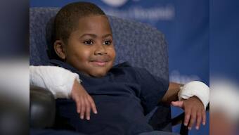 Eight-year old Zion Harvey becomes first child to receive double hand transplant