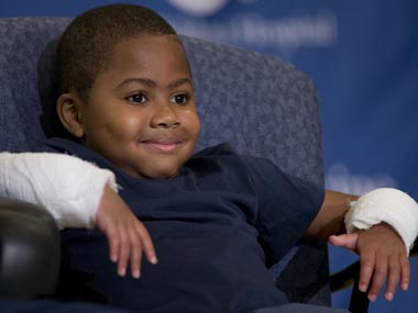 Eight-year old Zion Harvey becomes first child to receive double hand transplant Eight-year old Zion Harvey becomes first child to receive double hand transplant