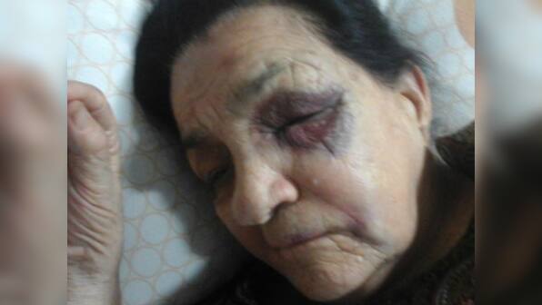 Parrikar assures all necessary help to war veteran hit by bureaucrat's car in Chandigarh