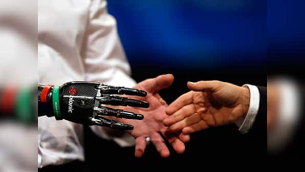 Paralyzed US man becomes first person to 'feel' sensations through prosthetic hand