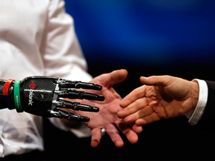 Paralyzed US man becomes first person to 'feel' sensations through prosthetic hand
