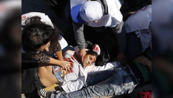 Ankara bomb attack: 30 killed, 126 injured in twin blasts in Turkey's capital, says interior minister