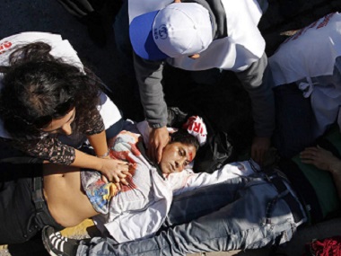 Ankara bomb attack: 30 killed, 126 injured in twin blasts in Turkey's capital, says interior minister Ankara bomb attack: 30 killed, 126 injured in twin blasts in Turkey's capital, says interior minister