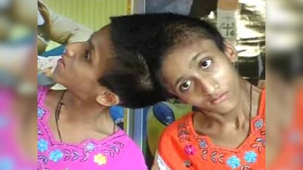 Bihar polls: Conjoined twins vote for the first time, but on one voter ID