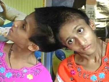 Bihar polls: Conjoined twins vote for the first time, but on one voter ID