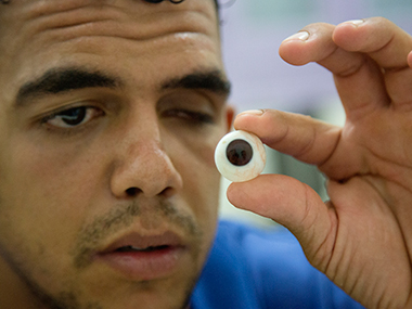Amid conflict, makers of artificial eyes bring real joy to people in Gaza strip Amid conflict, makers of artificial eyes bring real joy to people in Gaza strip