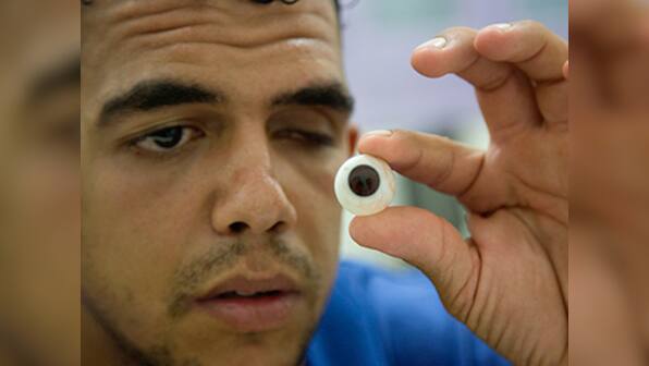 Amid conflict, makers of artificial eyes bring real joy to people in Gaza strip