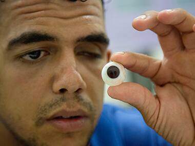 Amid conflict, makers of artificial eyes bring real joy to people in Gaza strip