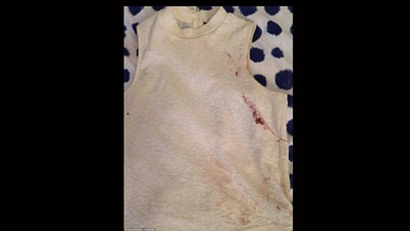 ‘You never think it will happen to you’: Paris attacks survivor recounts experience in emotional post