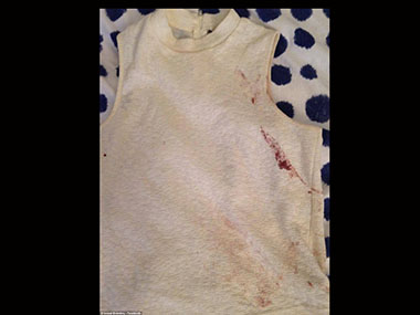 ‘You never think it will happen to you’: Paris attacks survivor recounts experience in emotional post ‘You never think it will happen to you’: Paris attacks survivor recounts experience in emotional post