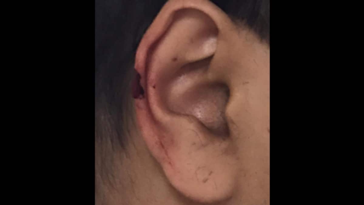 Hairstylist in Mumbai salon accidentally chops off part of man's ear