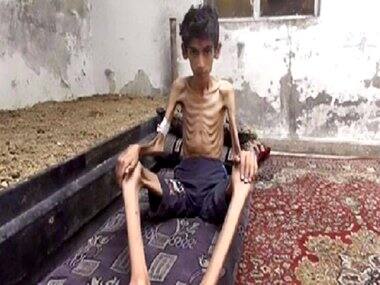 23 die of starvation in besieged Syrian town of Madaya, says MSF