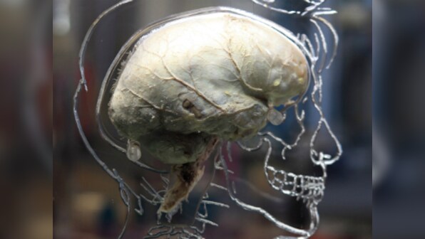 Skin cells to kill brain cancer: Researchers develop new method to fight deadly tumour