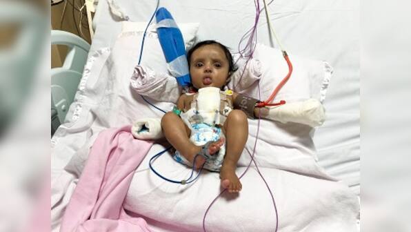 Rare surgery at Nita Ambani-led Sir HN Reliance Hospital saves 2-month old baby Aditi suffering multiple heart attacks