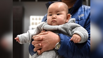 Ctrl+P saves the day: In a first, doctors use 3D printing technology to save nine-month-old in China