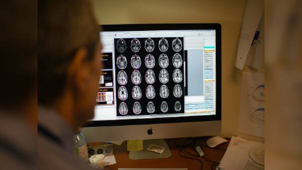 'Lost' memories of Alzheimer's patients may be recoverable, finds new study