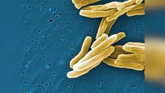 Gut bacteria can help reduce severity of stroke, finds new study