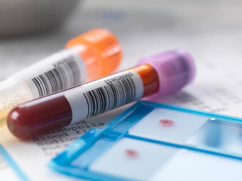 How blood plasma from survivors could help COVID-19 patients How blood plasma from survivors could help COVID-19 patients
