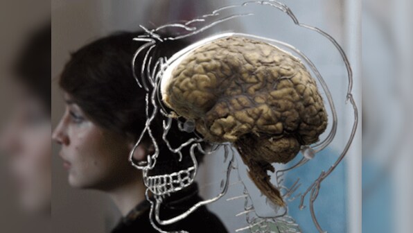 Zika virus may infect, kill human brain stem cells