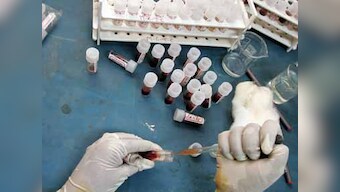 Fasting not necessary before a cholesterol test, suggest experts