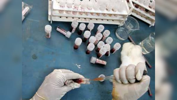 Fasting not necessary before a cholesterol test, suggest experts