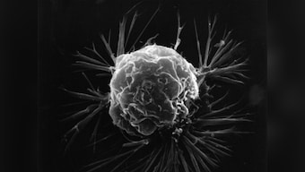 Microgravity, stem cells and cancer: IIT Madras takes a new approach to finding a treatment for cancer