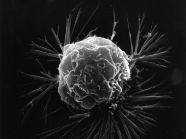 Microgravity, stem cells and cancer: IIT Madras takes a new approach to finding a treatment for cancer Microgravity, stem cells and cancer: IIT Madras takes a new approach to finding a treatment for cancer