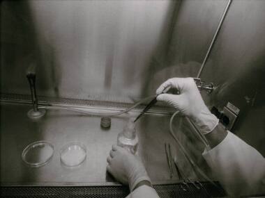 Organ transplant from animals may increase life span of humans but could risk quality of health