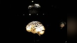Kenya neurosurgeon performs brain surgery on wrong patient at Kenyatta National Hospital, suspended
