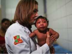 Zika infection may be linked to unreported eye problems in Brazilian infants