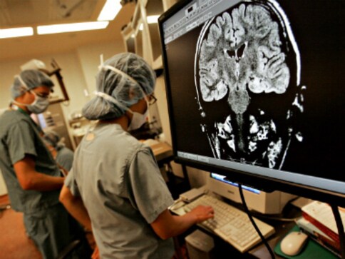 Scientists develop new algorithm can predict epileptic seizure Scientists develop new algorithm can predict epileptic seizure