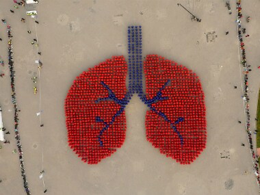 Representational image. Getty images