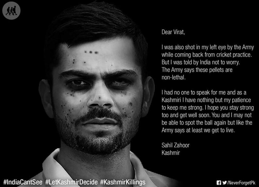 Kashmir unrest: Pellet war hits Kohli, Shah Rukh, Amitabh, Zuckerberg