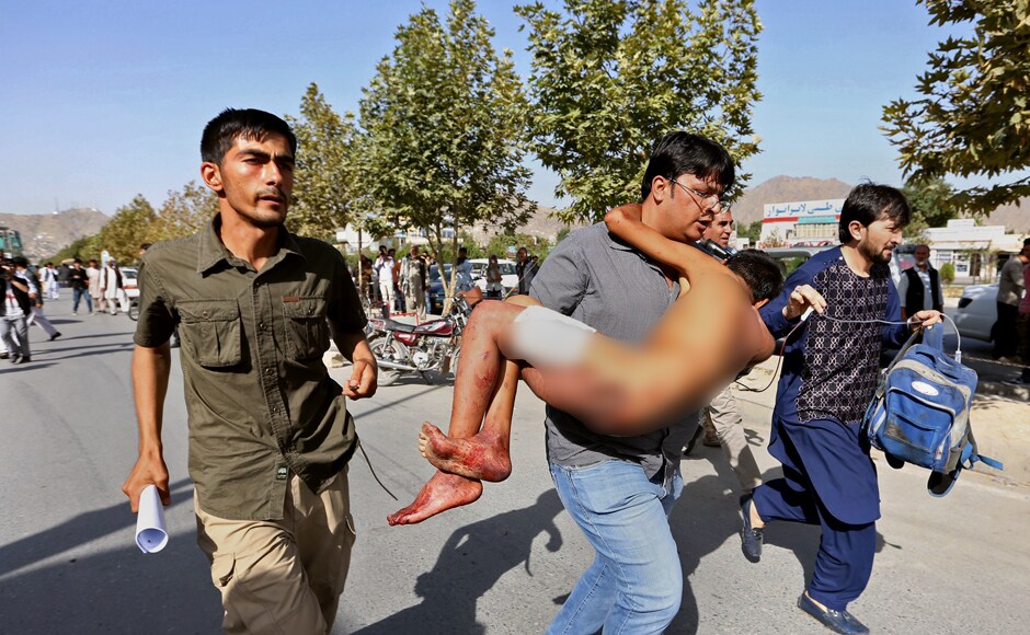 An injured boy is carried to a hospital after an explosion struck a protest in Kabul, Afghanistan, Saturday, July 23, 2016. Islamic State has claimed responsibility for the attacks according to a statement posted by IS-linked news agency Amaq. The death toll is feared to rise further as over 200 people are injured. AP An injured boy is carried to a hospital after an explosion struck a protest in Kabul, Afghanistan, Saturday, July 23, 2016. Islamic State has claimed responsibility for the attacks according to a statement posted by IS-linked news agency Amaq. The death toll is feared to rise further as over 200 people are injured. AP