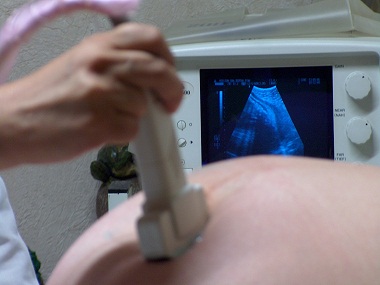 MTP Act: Should terminating a pregnancy be a medical decision or a judicial one? MTP Act: Should terminating a pregnancy be a medical decision or a judicial one?