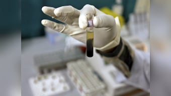 WHO Summit reveals nine out of 194 countries keeping pledge to eradicate hepatitis by 2030