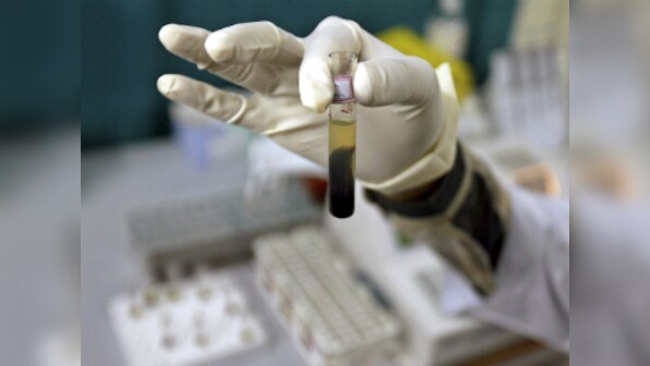 Generic versions for Hepatitis C treatment cost-effective in terms of life expectancy: Study