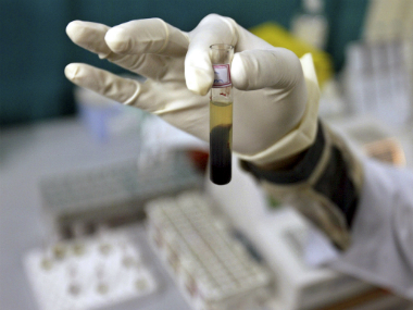 World Hepatitis Day 2019: History, significance, this year's theme and objectives of global awareness campaign against deadly disease World Hepatitis Day 2019: History, significance, this year's theme and objectives of global awareness campaign against deadly disease