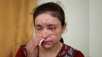 Raped, beaten and tortured, Islamic State's Yazidi sex slaves struggle to escape