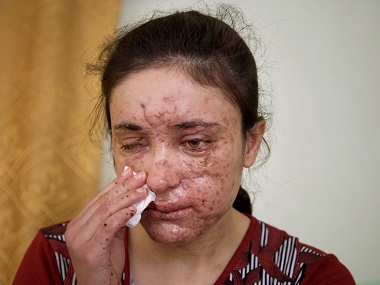 Raped, beaten and tortured, Islamic State's Yazidi sex slaves struggle to escape Raped, beaten and tortured, Islamic State's Yazidi sex slaves struggle to escape