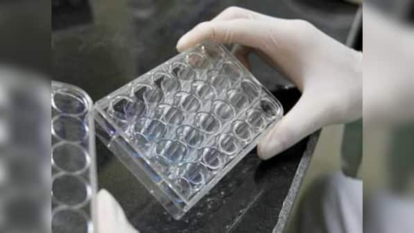 Scientists at National Institute of Virology discover new genotype of the Dengue virus
