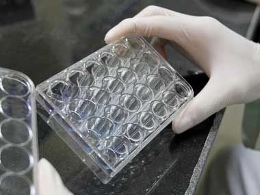 Scientists at National Institute of Virology discover new genotype of the Dengue virus Scientists at National Institute of Virology discover new genotype of the Dengue virus