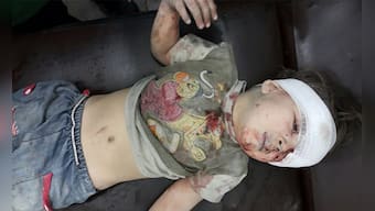 Syrian civil war: The image of a child covered in blood is a reminder of the horrors of the conflict