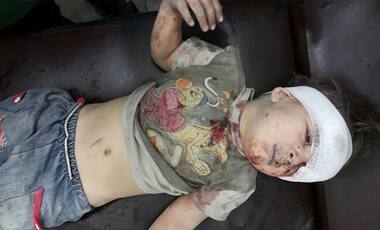 Syrian civil war: The image of a child covered in blood is a reminder of the horrors of the conflict