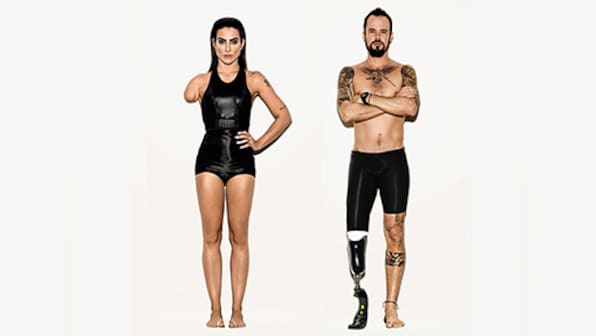 Vogue Brazil sparks outrage for photoshopping able-bodied models for Rio Paralympics cover