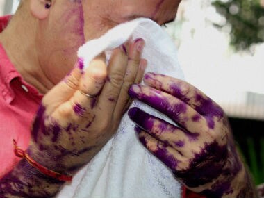 Manish Sisodia wipes ink off his face. PTI