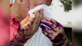 Opposition condemns ink attack on Manish Sisodia, holds AAP 'responsible'