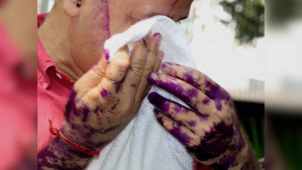 Opposition condemns ink attack on Manish Sisodia, holds AAP 'responsible'