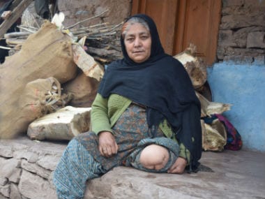 Saleema Begum was hit by six bullets in her leg. It was amputated later. Image courtesy: Sameer Yasir/Firstpost